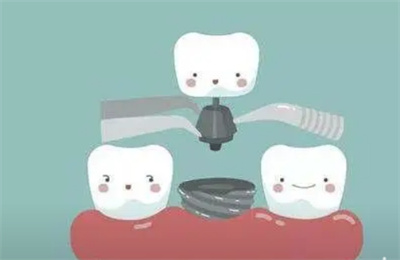 http://www.bstoo.cn/d/file/price/b0b2irzn8obw.jpg