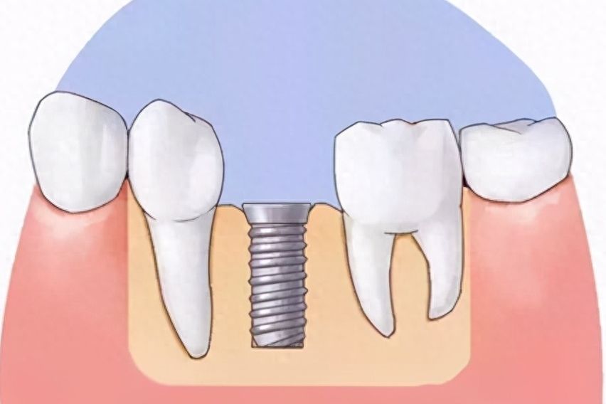 http://www.bstoo.cn/d/file/price/b0xg7kga498i.jpg