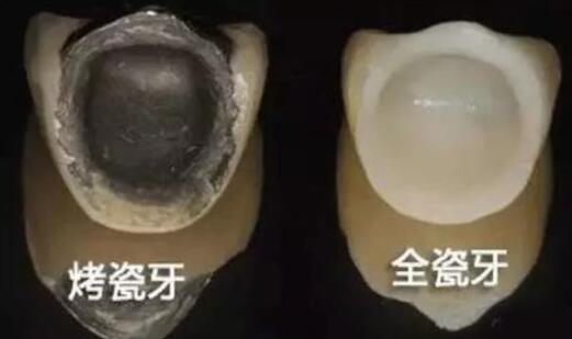 http://www.bstoo.cn/d/file/price/bd3x8ql2zqx8.jpg