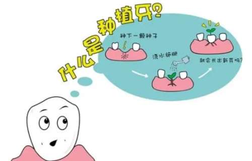 義烏全瓷牙種植價格清單