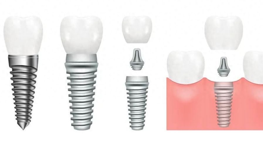 http://www.bstoo.cn/d/file/price/bwbf40hho1q3.jpg