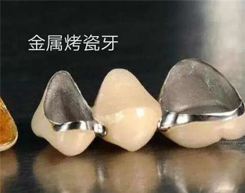 http://www.bstoo.cn/d/file/price/cd2ki7sly2gk.jpg