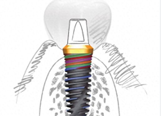 http://www.bstoo.cn/d/file/price/dg0eacqly87r.jpg