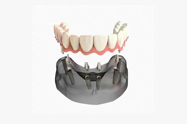 http://www.bstoo.cn/d/file/price/dgvy2nws18g9.jpg