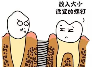 http://www.bstoo.cn/d/file/price/dspu5ivs0l.jpg