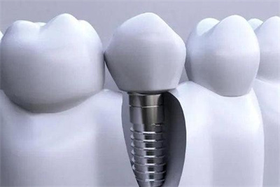 http://www.bstoo.cn/d/file/price/durzq3o0y5ml.jpg