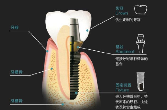 http://www.bstoo.cn/d/file/price/e2hjj94s8o.jpg