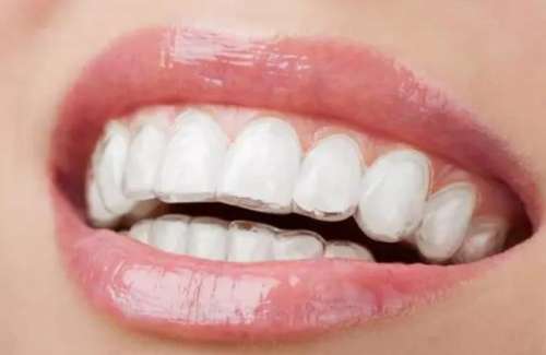 http://www.bstoo.cn/d/file/price/e9xr4u03w10r.jpg