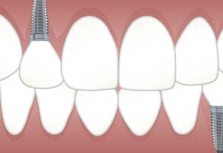 http://www.bstoo.cn/d/file/price/eapbjbjuv8.jpg