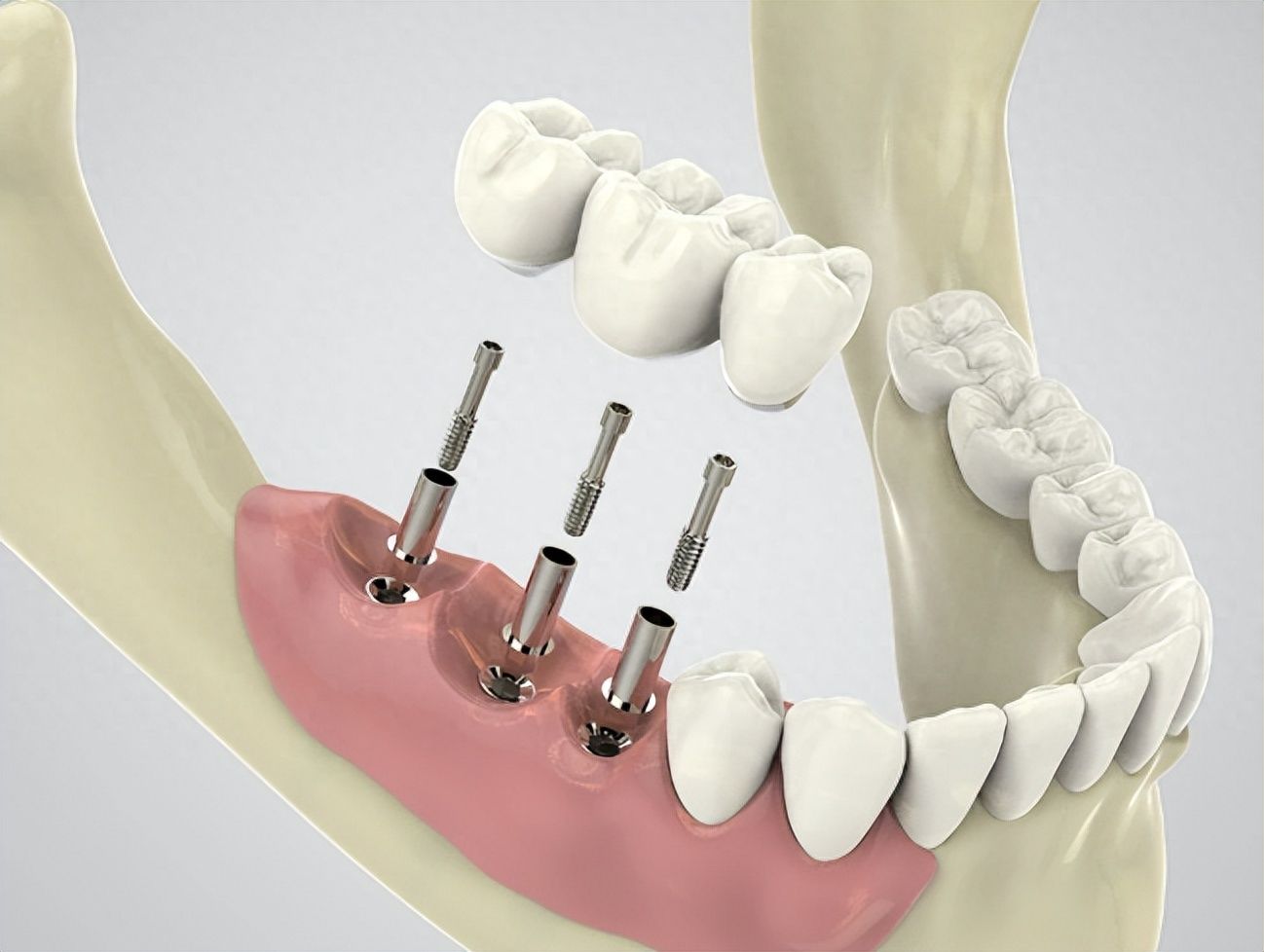 http://www.bstoo.cn/d/file/price/ekg8zuvxxp49.jpg