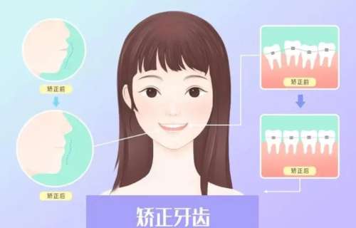 http://www.bstoo.cn/d/file/price/eksqmk771c9u.jpg