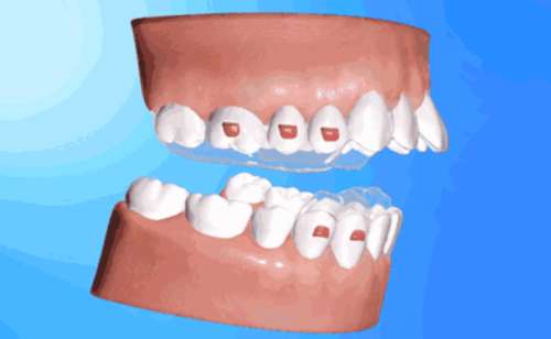 http://www.bstoo.cn/d/file/price/er5agw28u851.jpg