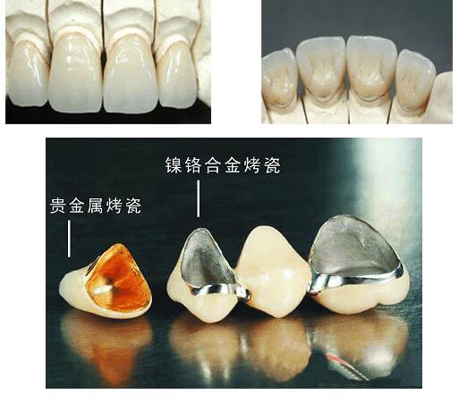 http://www.bstoo.cn/d/file/price/ewhyekw7zm7z.jpg