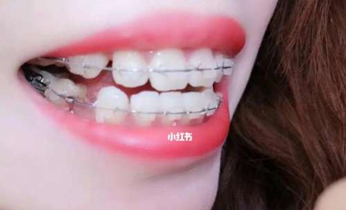 http://www.bstoo.cn/d/file/price/fdpa7pealgi9.jpg