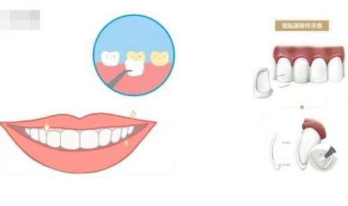http://www.bstoo.cn/d/file/price/fj3303vd69.jpg