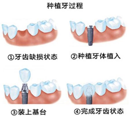 http://www.bstoo.cn/d/file/price/fs92wdykp6xk.jpg