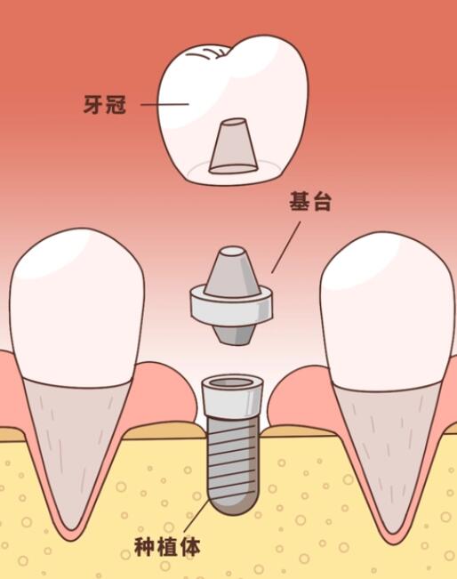 http://www.bstoo.cn/d/file/price/g279r1ykey73.jpg