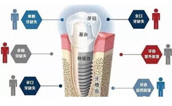 http://www.bstoo.cn/d/file/price/g3pwir3wjlbi.jpg