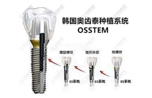 http://www.bstoo.cn/d/file/price/gcsdesbxrj.jpg