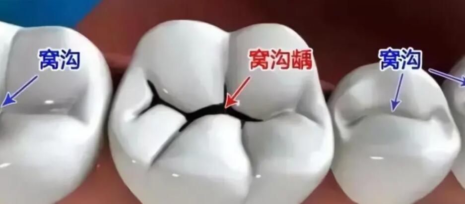 http://www.bstoo.cn/d/file/price/gkpcm6h2b2.jpg
