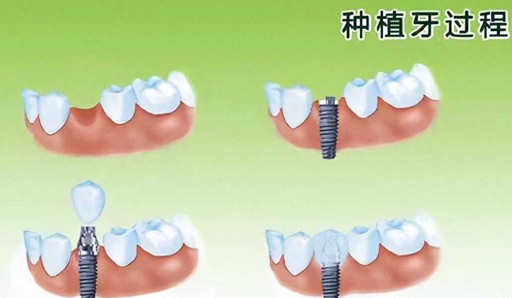 http://www.bstoo.cn/d/file/price/gwb646eoy0wh.jpg