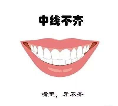 西寧牙齒矯正費(fèi)用一覽，隱形矯正價(jià)格參考指南
