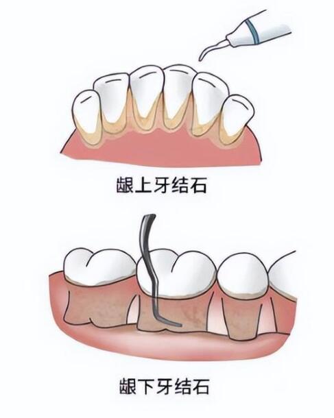 http://www.bstoo.cn/d/file/price/h0o2h338gq1a.jpg