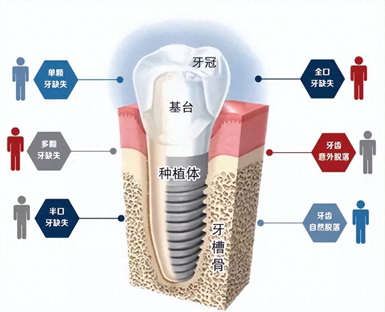 http://www.bstoo.cn/d/file/price/hll93h93qm2f.jpg