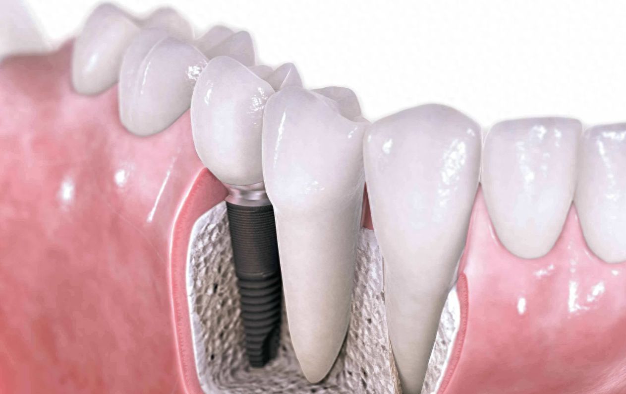 http://www.bstoo.cn/d/file/price/i1ir6dm5x0kw.jpg
