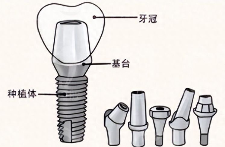 http://www.bstoo.cn/d/file/price/ifr0ca76fdfg.jpg