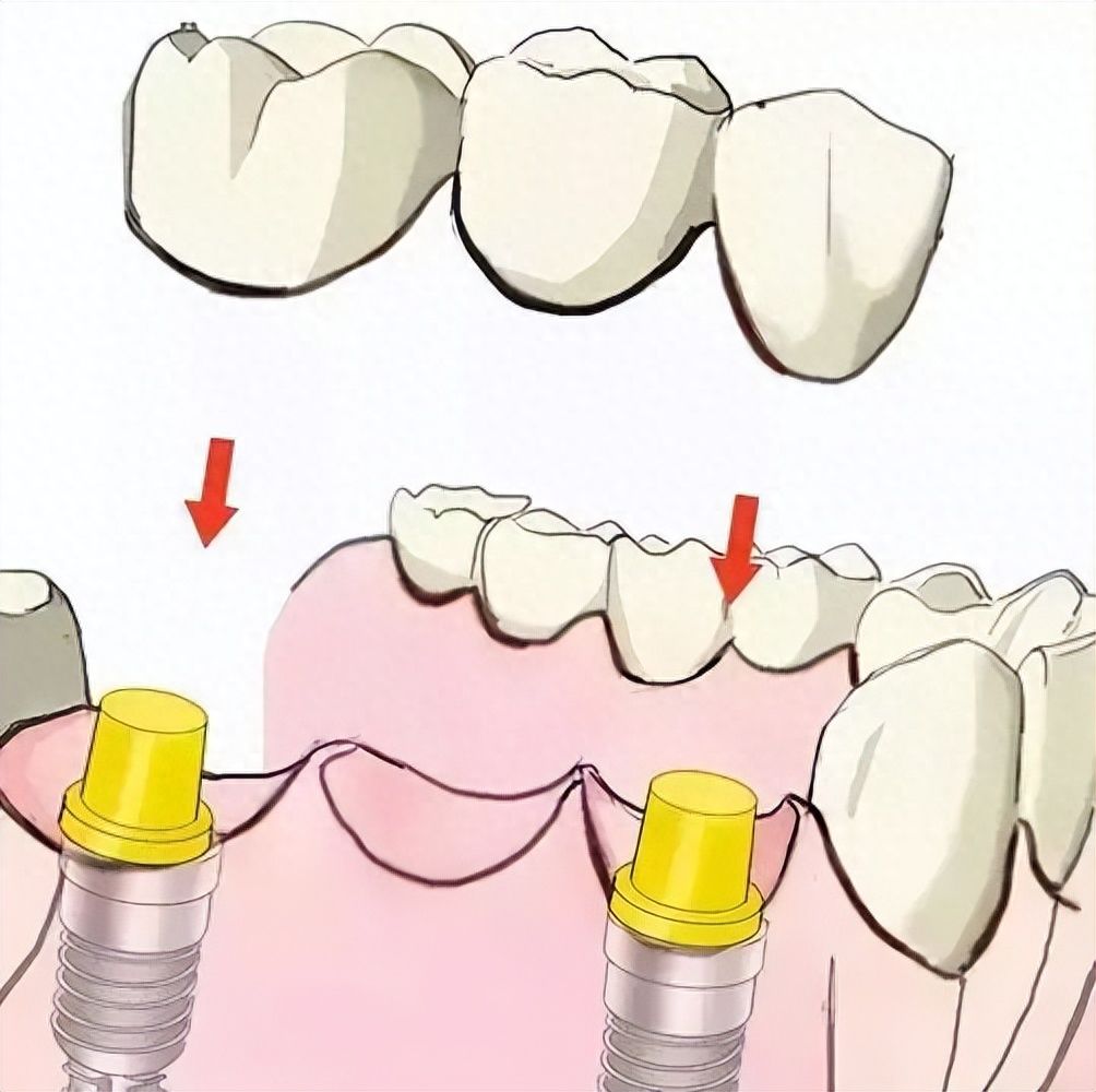http://www.bstoo.cn/d/file/price/itarnkn9x2xr.jpg