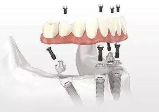 http://www.bstoo.cn/d/file/price/izgrp2ih3hyt.jpg