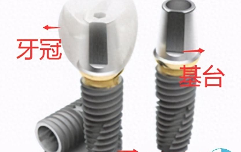 http://www.bstoo.cn/d/file/price/j30fb6xuvj1h.jpg