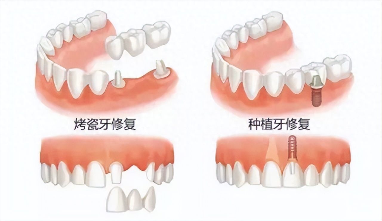http://www.bstoo.cn/d/file/price/j4si1aad7m.jpg