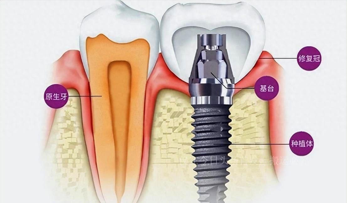 http://www.bstoo.cn/d/file/price/j6kit02hefce.jpg