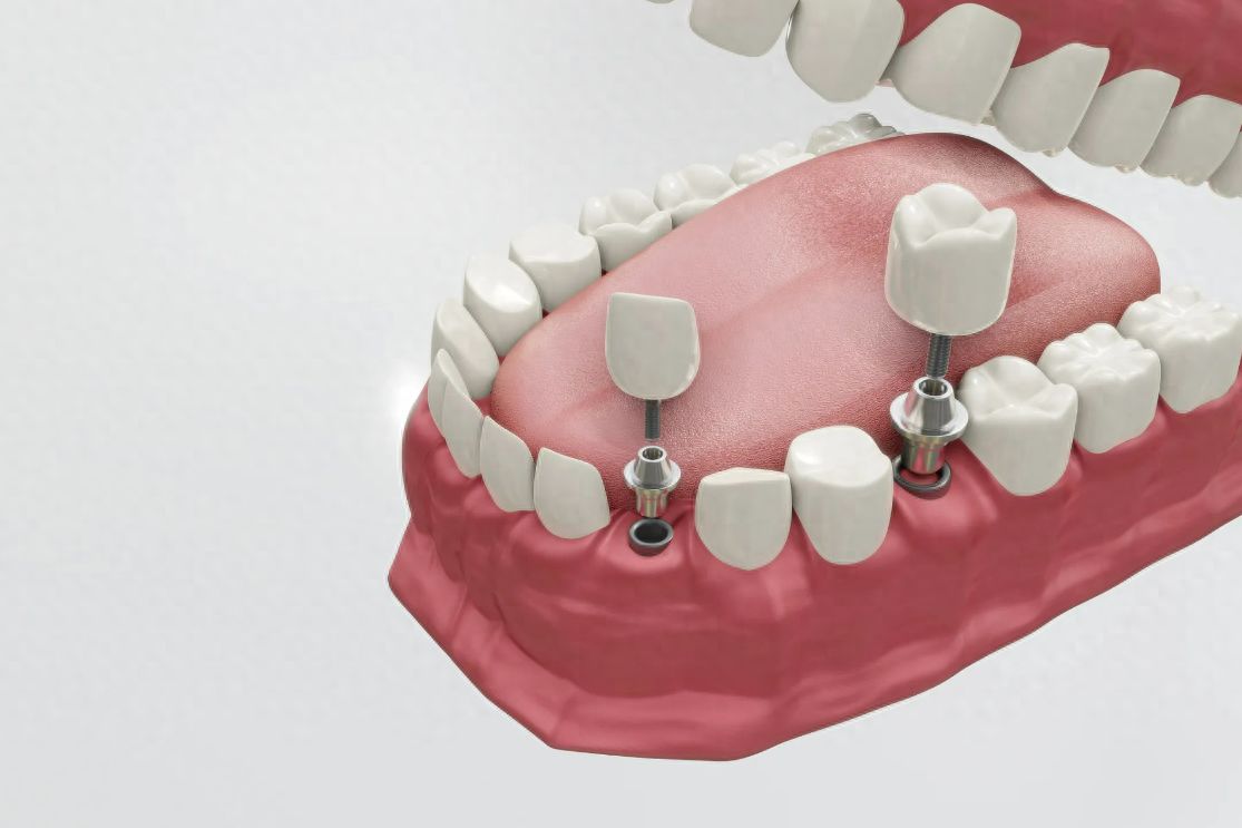 http://www.bstoo.cn/d/file/price/j8no514xihex.jpg