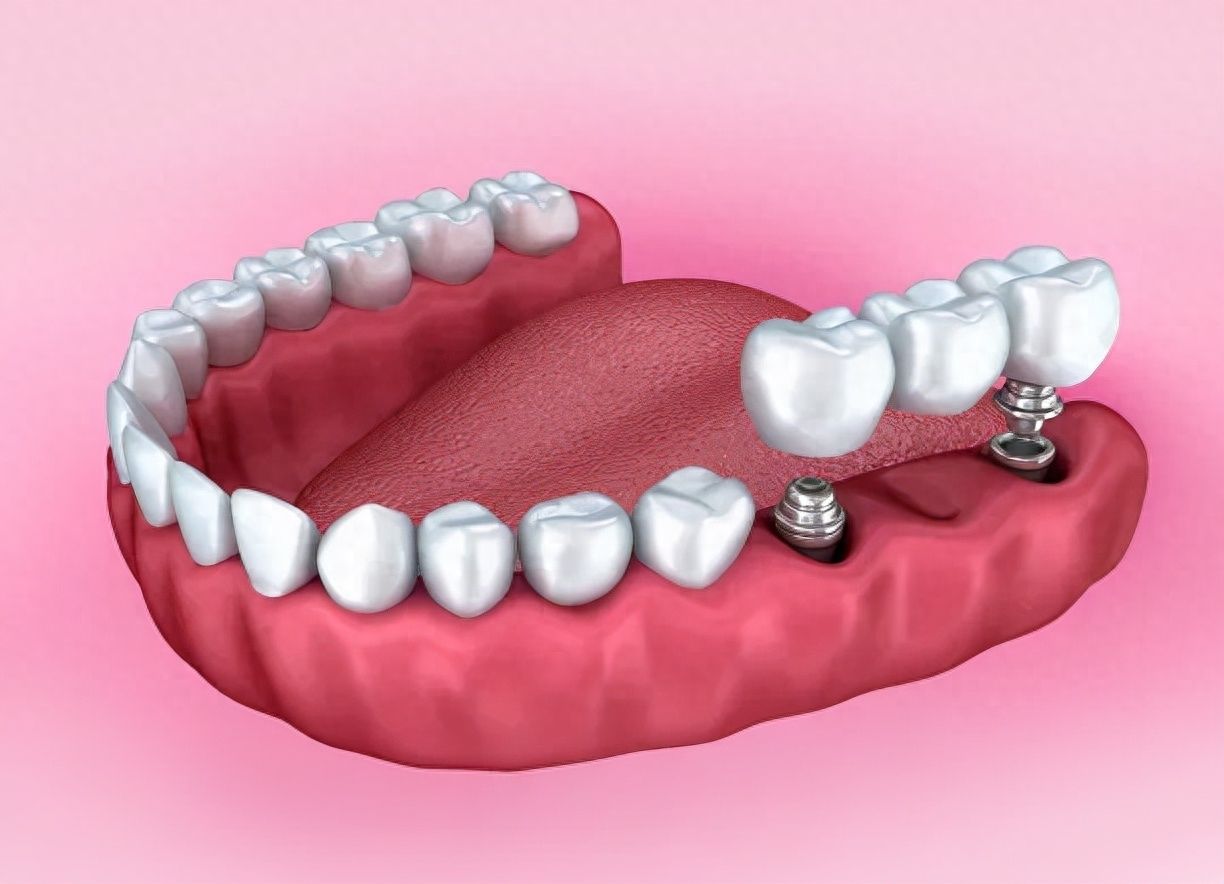 http://www.bstoo.cn/d/file/price/jiaq254wirux.jpg