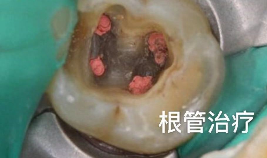 http://www.bstoo.cn/d/file/price/jrhxf9h42wyi.jpg