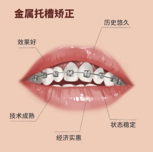 http://www.bstoo.cn/d/file/price/jztf2341kvxn.jpg