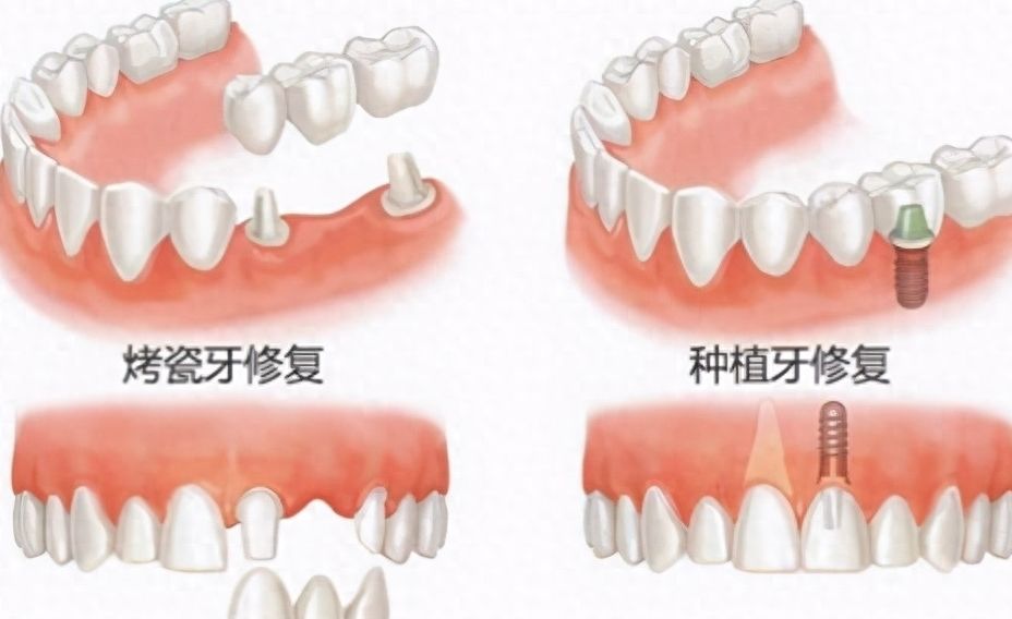 http://www.bstoo.cn/d/file/price/kgw8qcmjo7ft.jpg