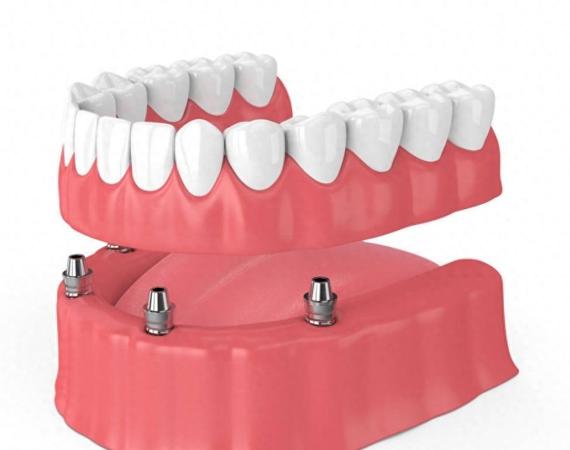 http://www.bstoo.cn/d/file/price/kj1mpww8v4oz.jpg