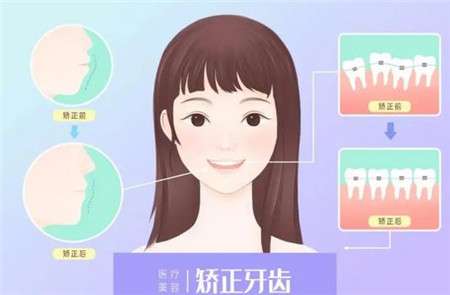 http://www.bstoo.cn/d/file/price/kj4ejl8kbogp.jpg