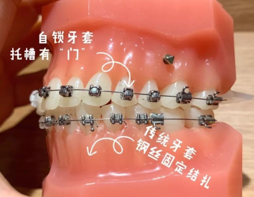 http://www.bstoo.cn/d/file/price/knm4t00vg2qo.jpg