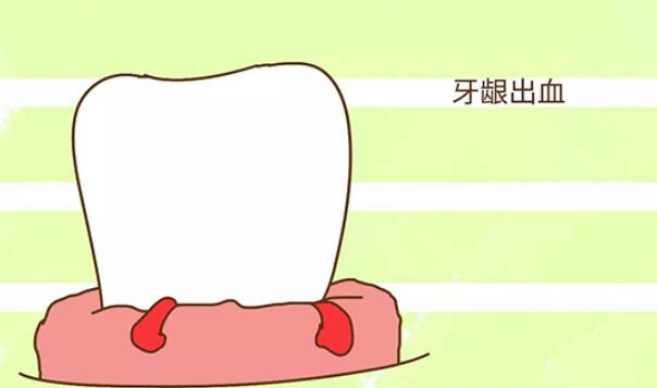 http://www.bstoo.cn/d/file/price/ksv8pdy8co4v.jpg
