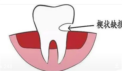http://www.bstoo.cn/d/file/price/ld4jfs6ogyn4.jpg