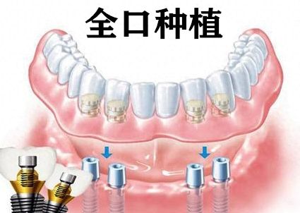 http://www.bstoo.cn/d/file/price/lezippldm9rq.jpg