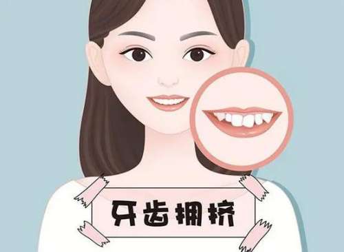 http://www.bstoo.cn/d/file/price/ljgpzl0xwh35.jpg