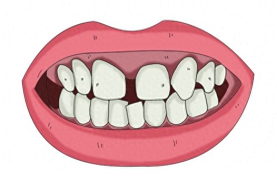 http://www.bstoo.cn/d/file/price/llfaonlmh3jm.jpg