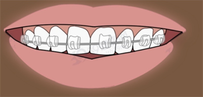 http://www.bstoo.cn/d/file/price/lmnudzr0zs.jpg