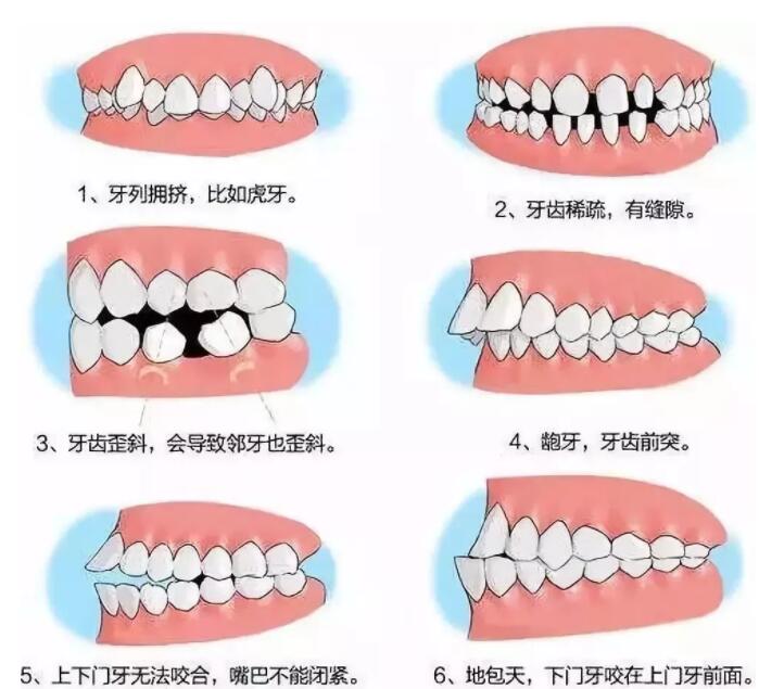 http://www.bstoo.cn/d/file/price/lnozl968r60f.jpg